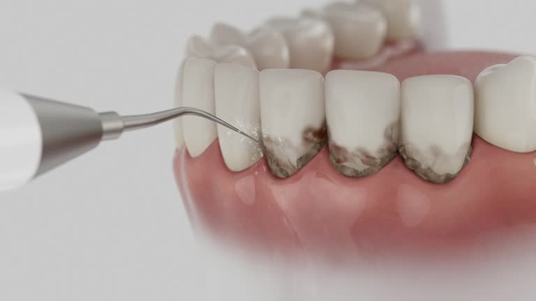 Reliable Dental contractor in Glendale, OH by Dentist Open Now